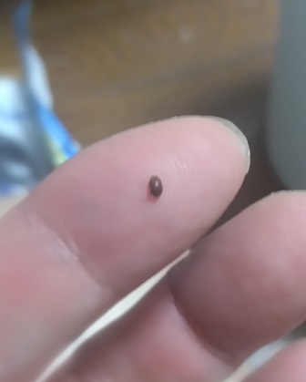 黒い小さい丸い虫　部屋　カブトムシの雌　指の先